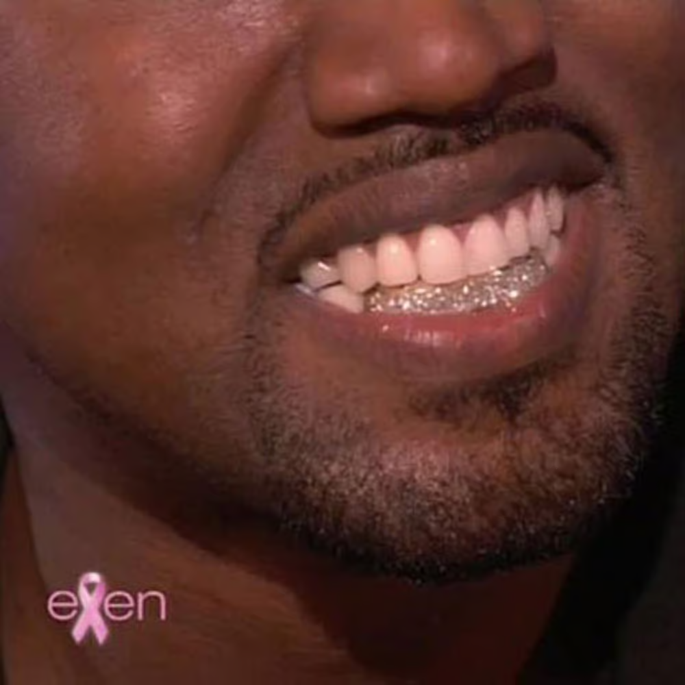  Kanye West teeth close-up smile 
