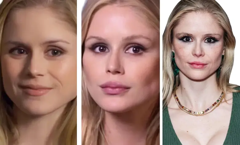 Erin Moriarty Plastic Surgery – Stunning Truths