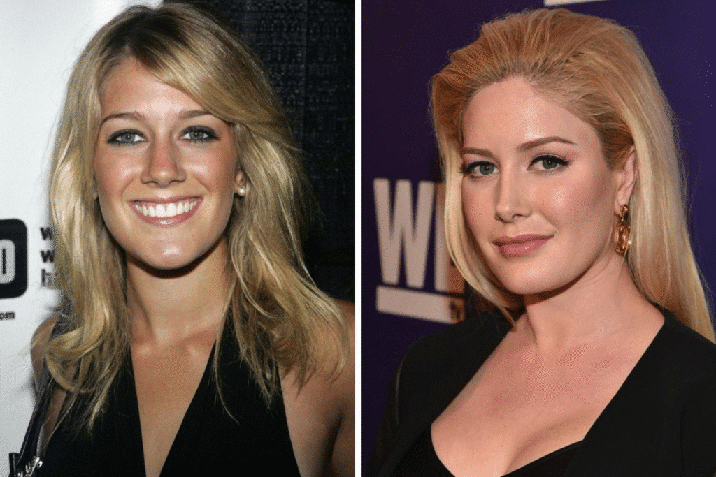 (title)% Heidi Montag plastic surgery controversy with Spencer Pratt