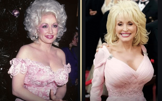 Dolly Parton plastic surgery discussion - smiling portrait of Dolly Parton in 2011 