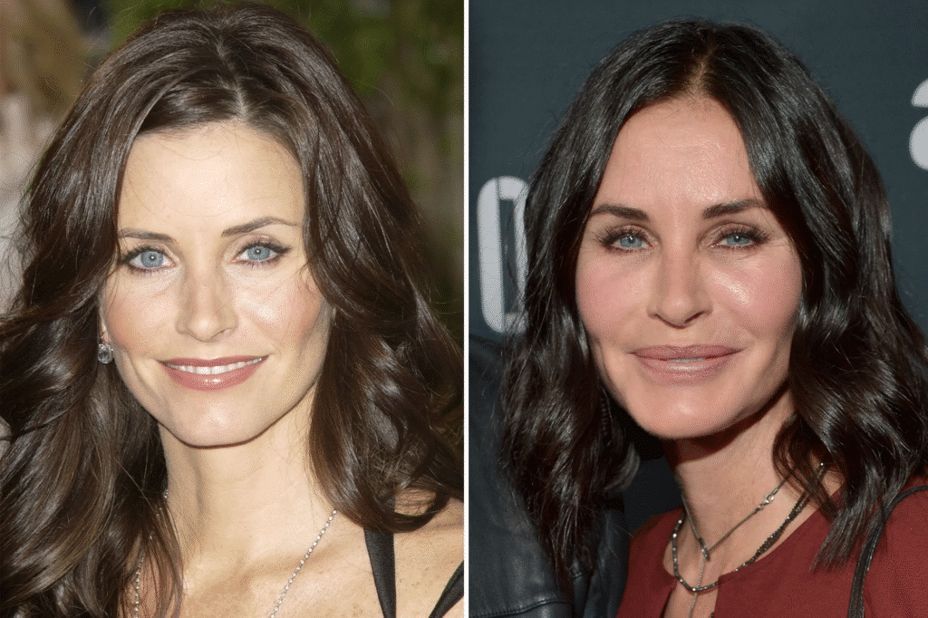 Courtney Cox Plastic Surgery transformation photo 