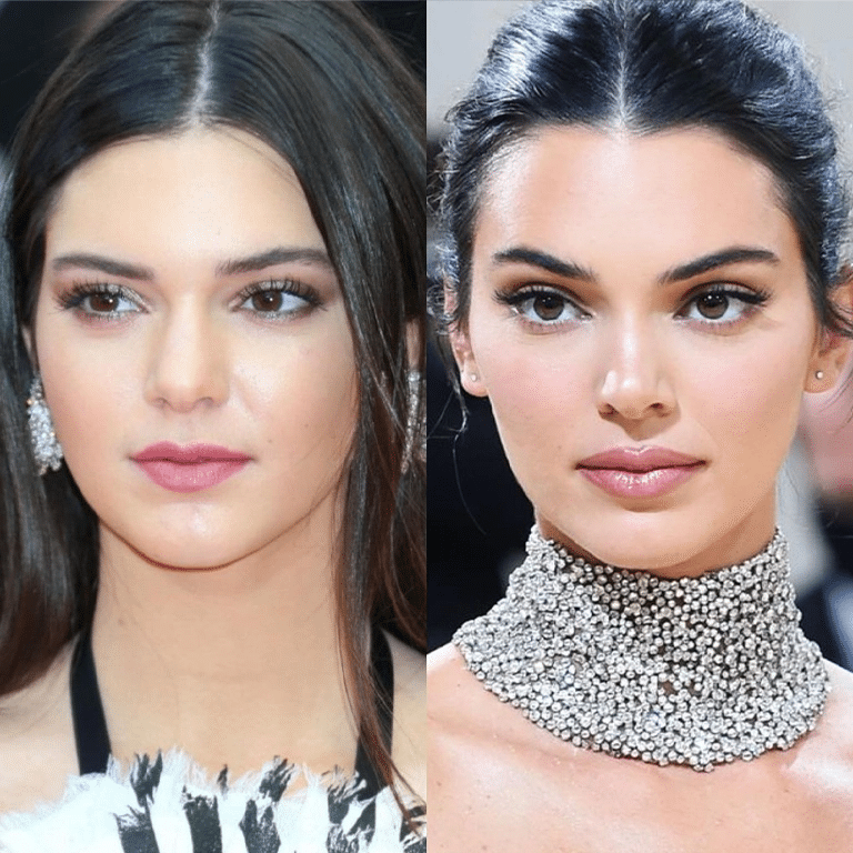 (title)% Kendall Jenner plastic surgery speculation, before and after modeling photos