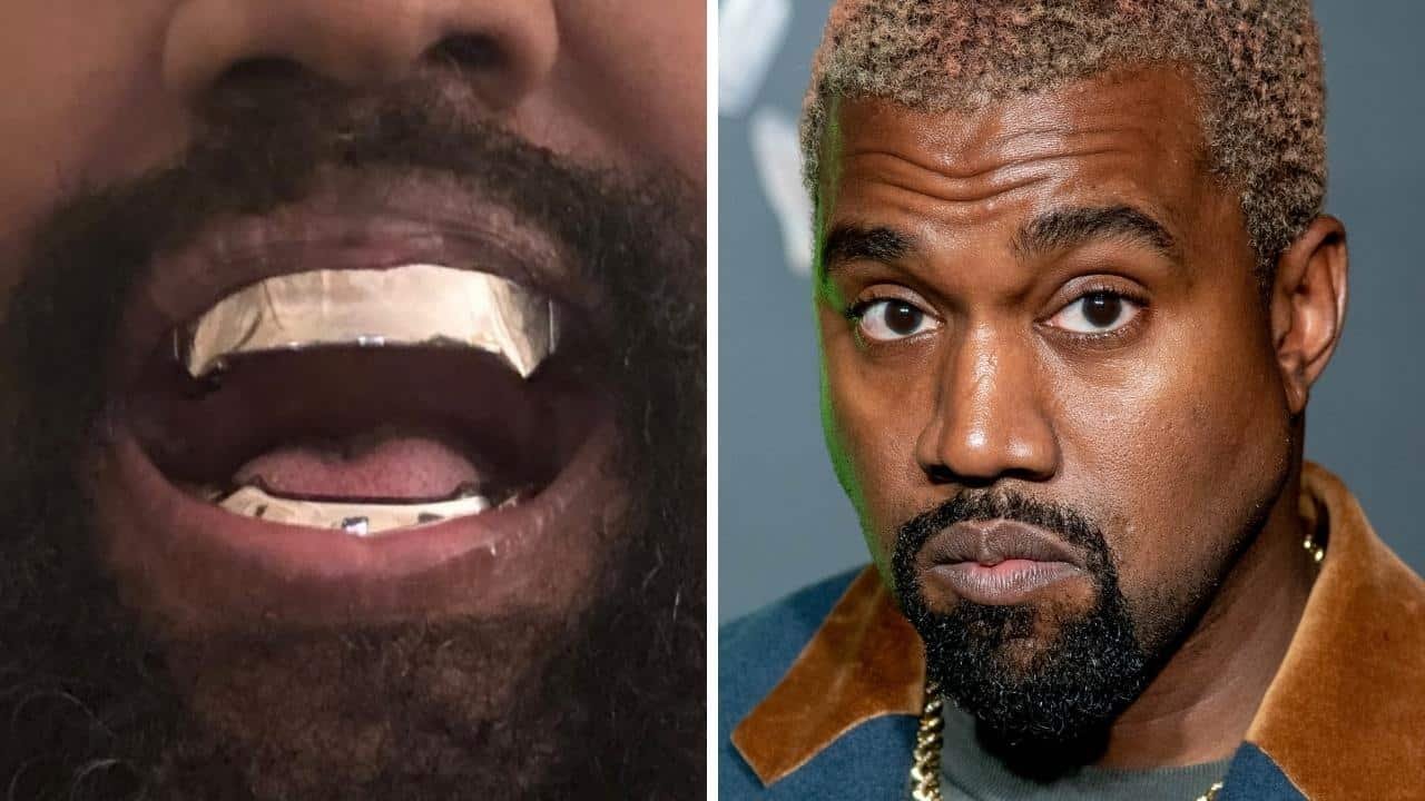 Kanye Teeth: 7 Shocking Yet Inspiring Truths