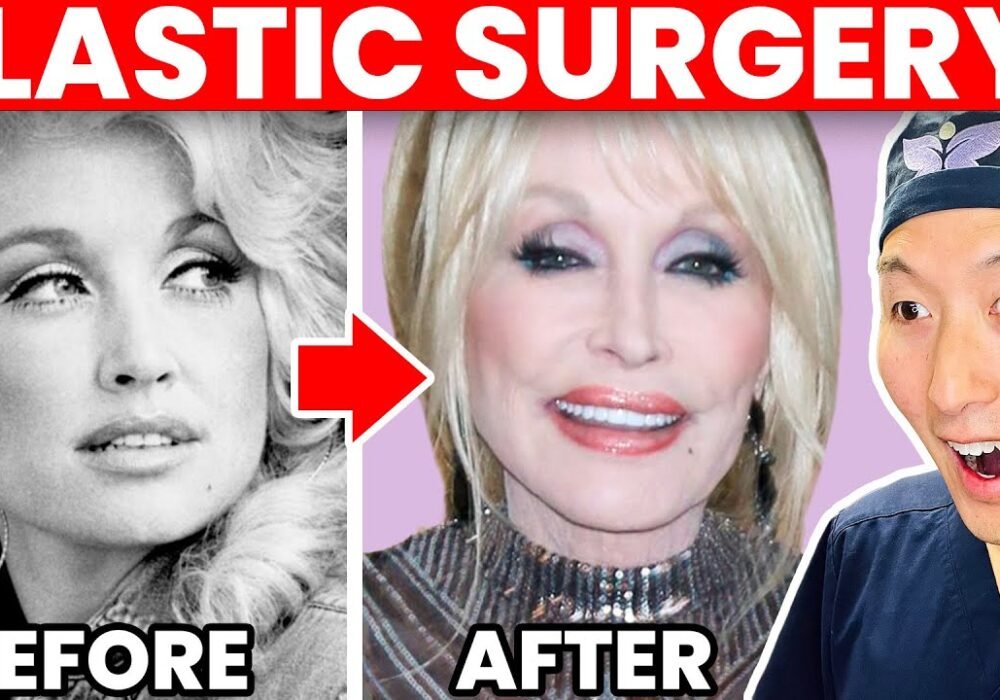 Dolly Parton Plastic Surgery Facts