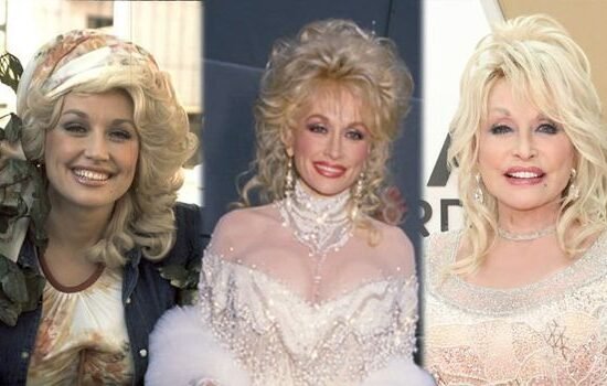 Dolly Parton Before Plastic Surgery