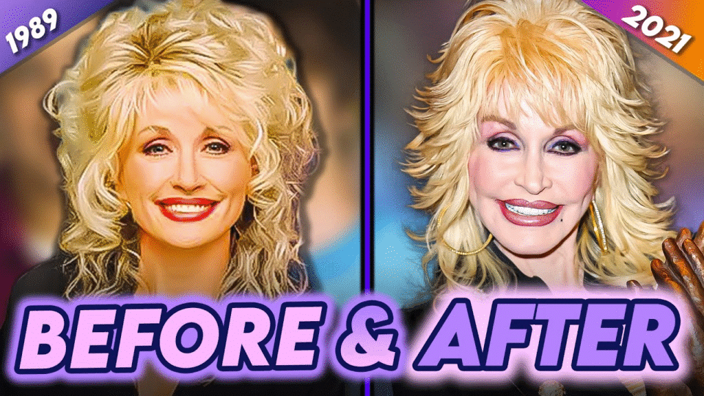  Dolly Parton young, natural look before cosmetic surgery 