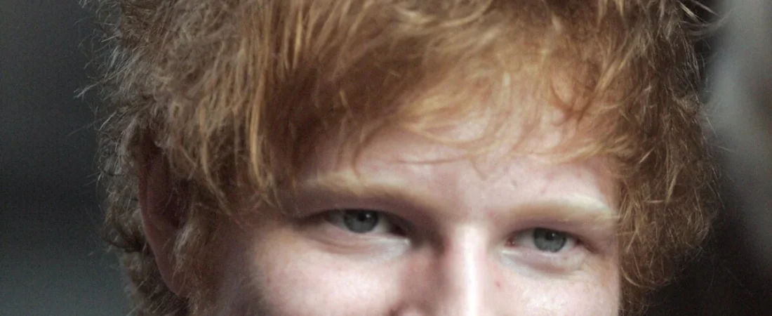 Ed Sheeran Wife Cherry Seaborn Surgery: Scary Health Update That Has Fans Worried in 2026